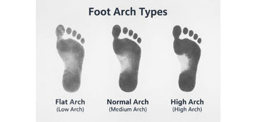 Foot Arch Types: Flat, Normal and High Arches